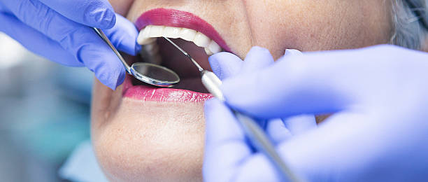 Best Emergency Tooth Extraction in Sanford, ME